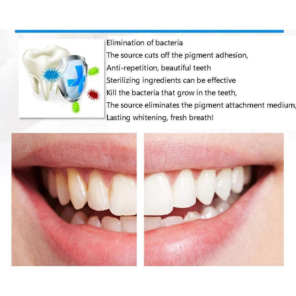 Bright Smile Whitening Strips